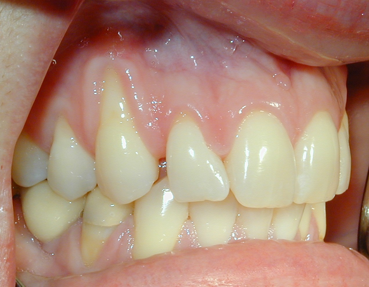 Oral Biopsies – Operative Warnings11