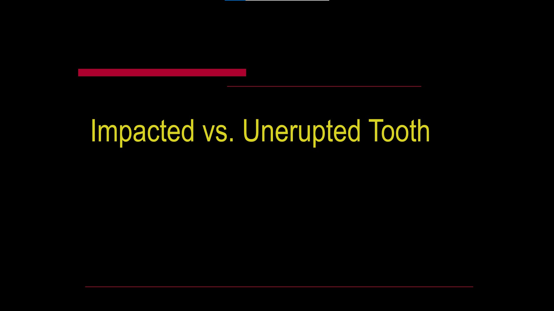 Impacted teeth1